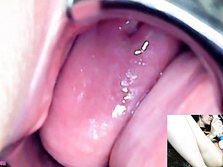 Adalynnx - Spekulum Endoskop Hitachi Vibrator Cum